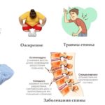 Факторы риска заболеваний суставов и позвоночника